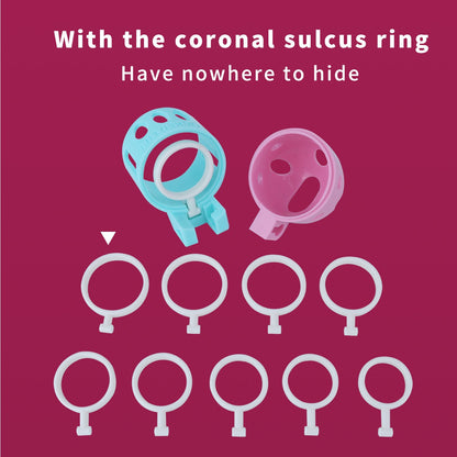 Ringless Male Chastity Cage – Coronal Sulcus Lock Design | Clasp-Free Chastity Cage